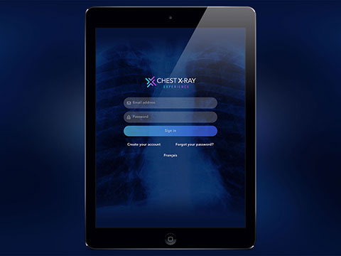 Chest X-Ray Experience