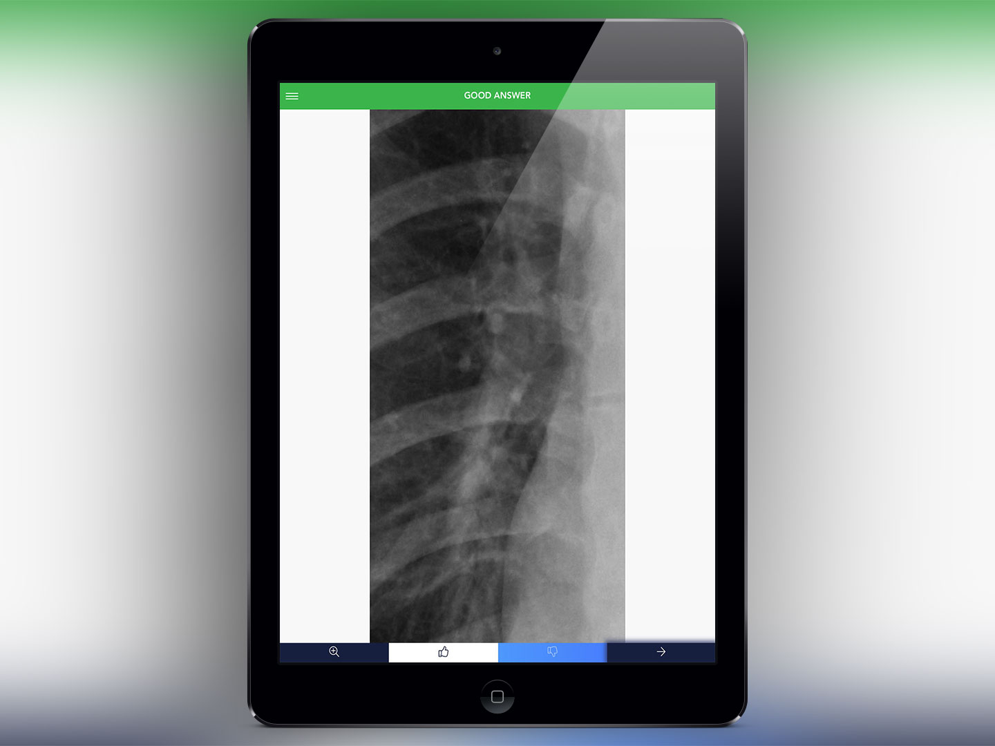 Chest X-Ray Experience