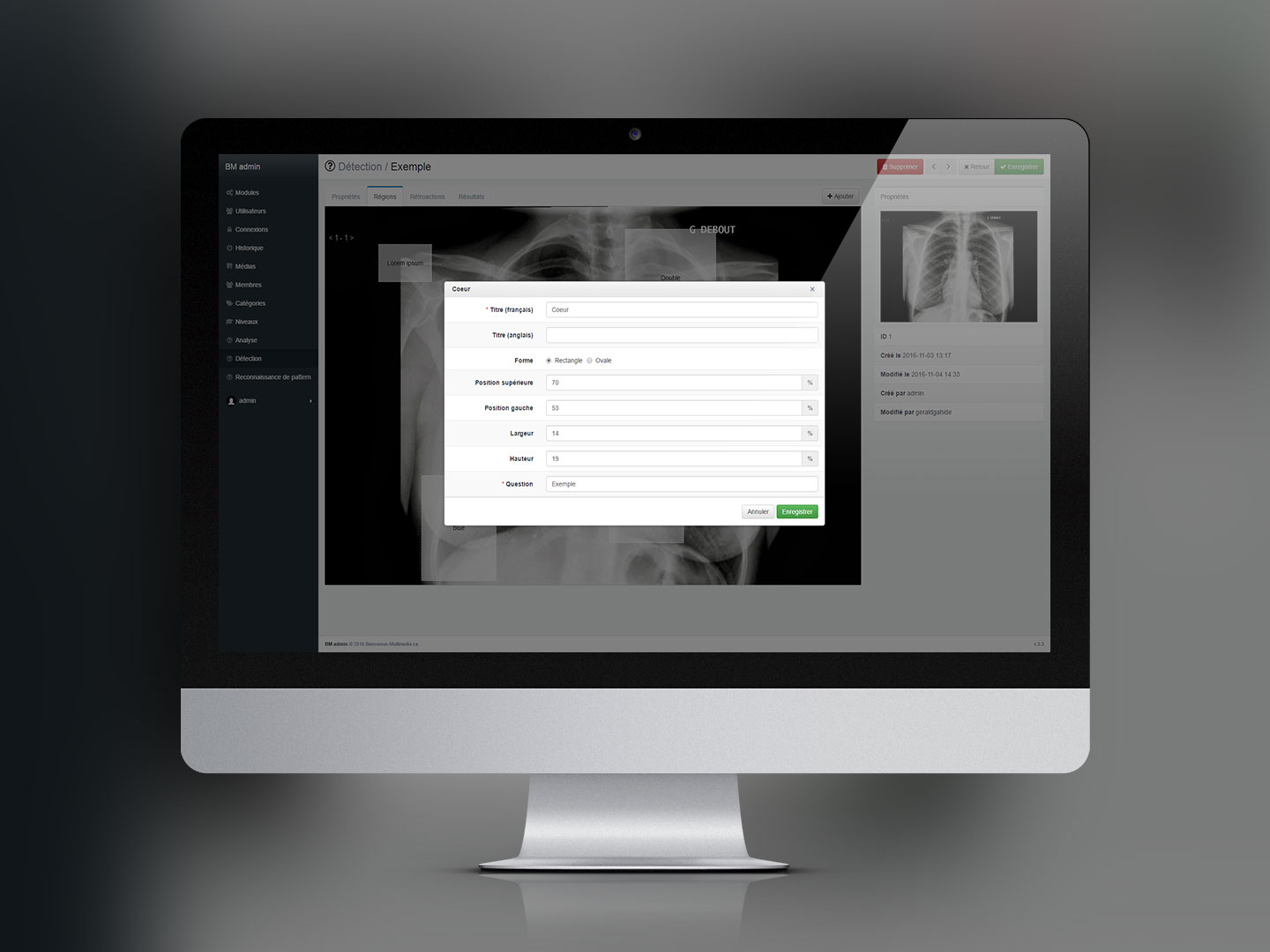 Chest X-Ray Experience
